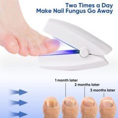 Tırnak Mantar Cihazı